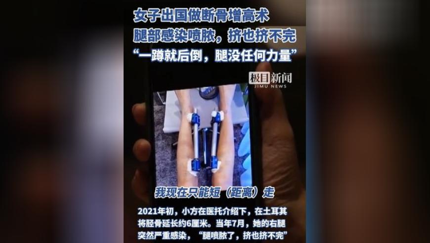 TVB演员沈震轩回应开网约车,奥门马今晚开奖结果,公开决策资料解释落实_终极版V7.26